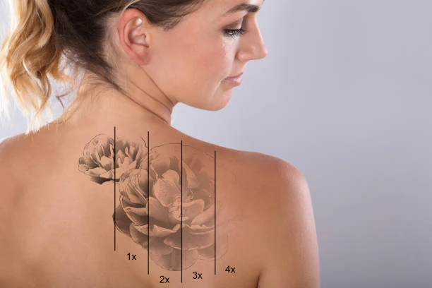 tattoo fading stages on shoulder